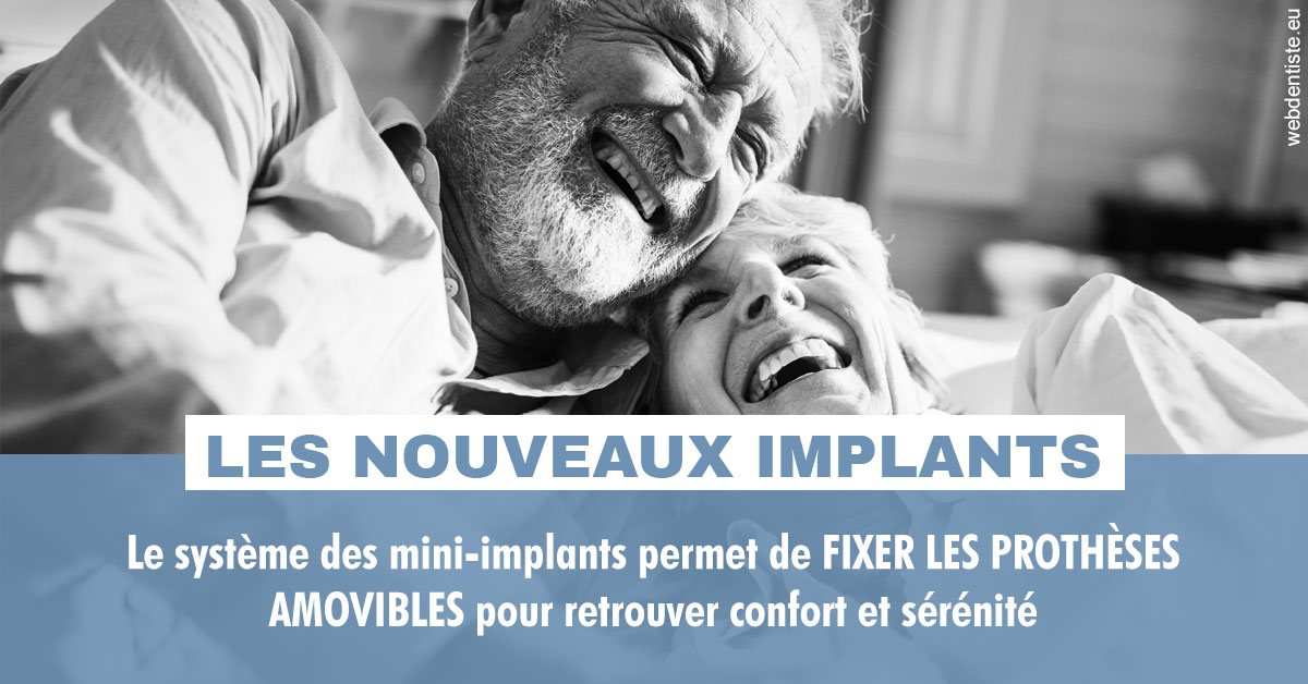 https://www.dentiste-pineau.fr/Les nouveaux implants 2