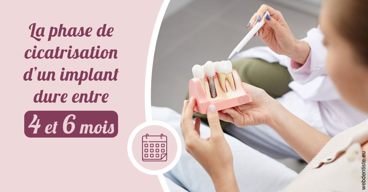 https://www.dentiste-pineau.fr/Cicatrisation implant 2