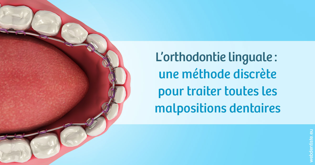 https://www.dentiste-pineau.fr/L'orthodontie linguale 1