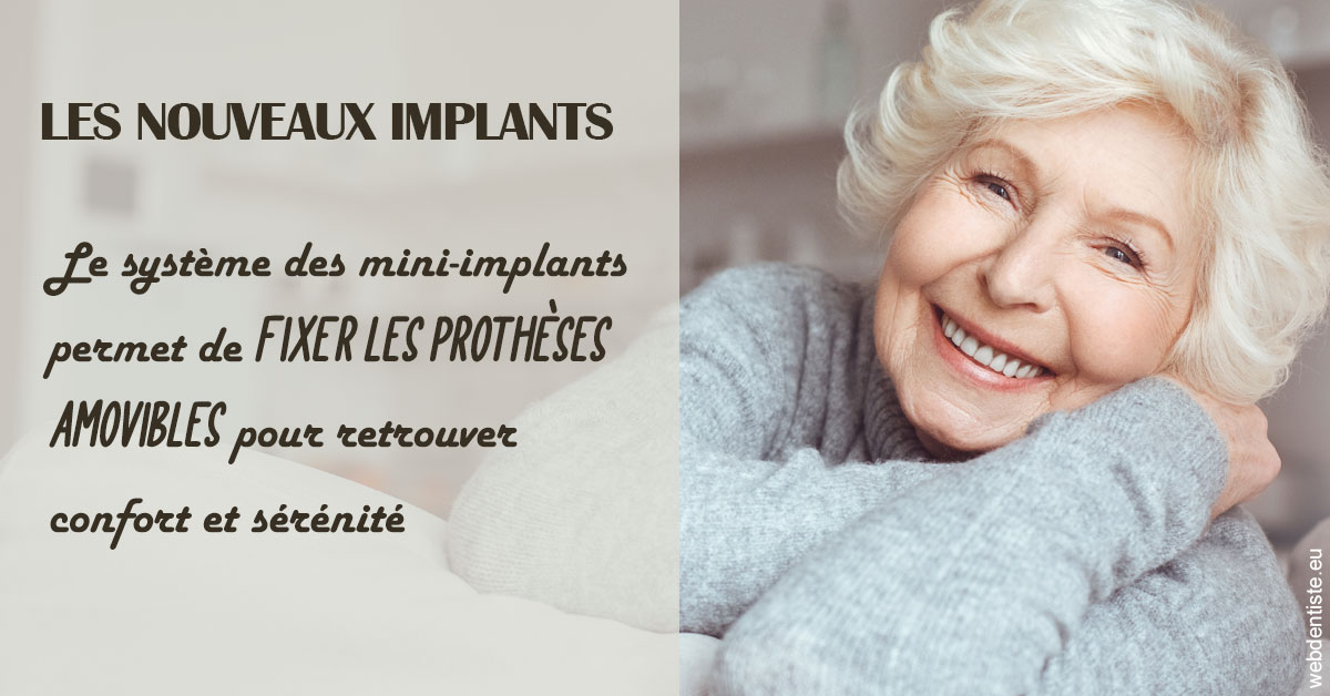 https://www.dentiste-pineau.fr/Les nouveaux implants 1