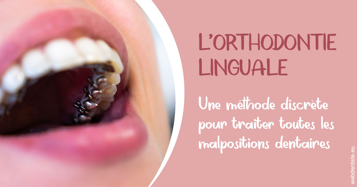 https://www.dentiste-pineau.fr/L'orthodontie linguale 2