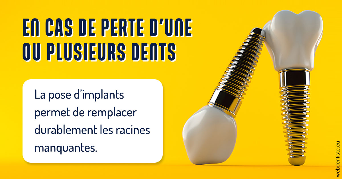 https://www.dentiste-pineau.fr/2024 T1 - Implants 02