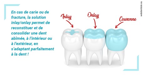 https://www.dentiste-pineau.fr/L'INLAY ou l'ONLAY