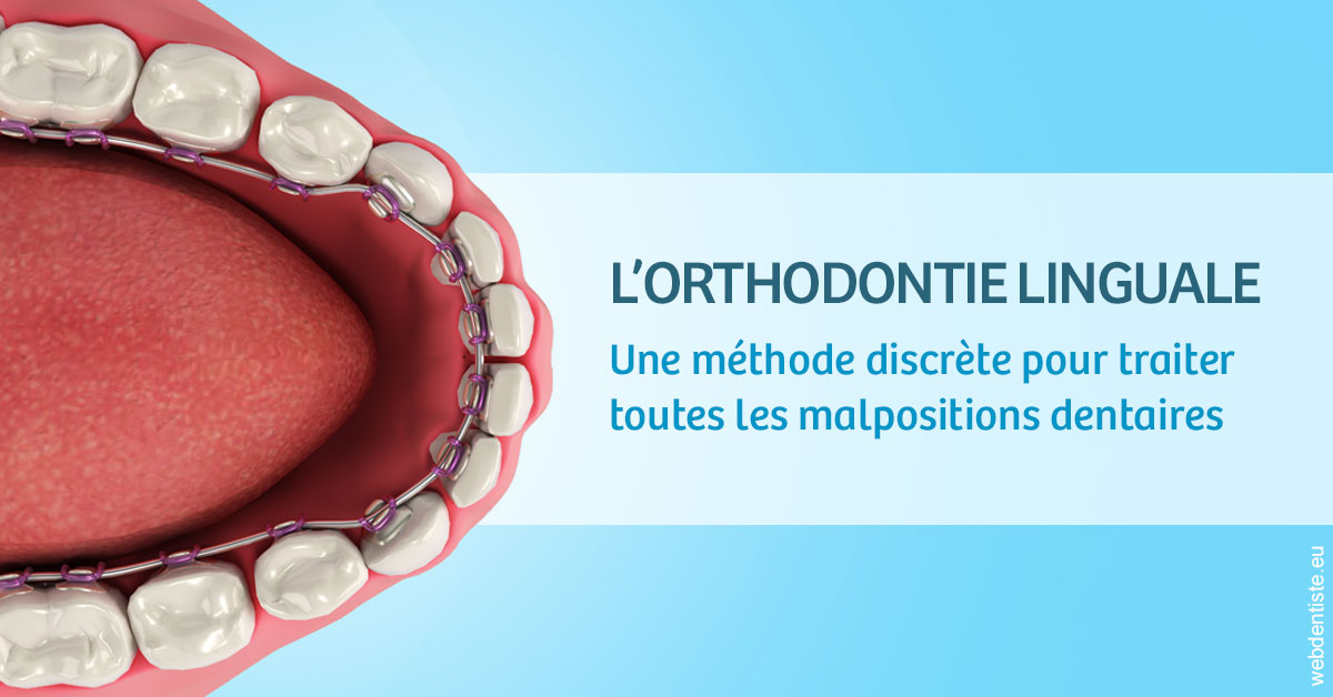 https://www.dentiste-pineau.fr/L'orthodontie linguale 1