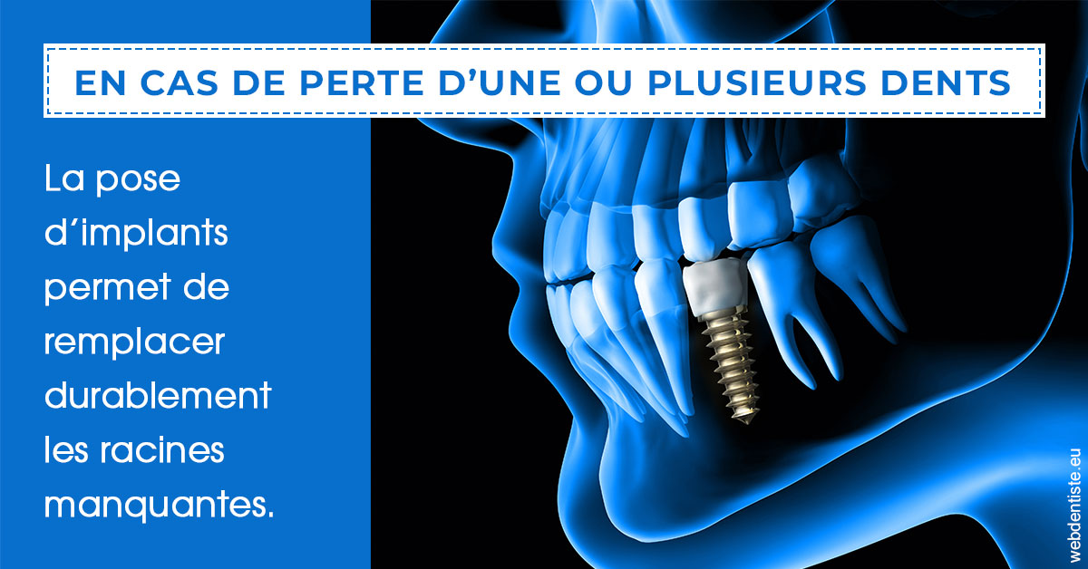 https://www.dentiste-pineau.fr/2024 T1 - Implants 01
