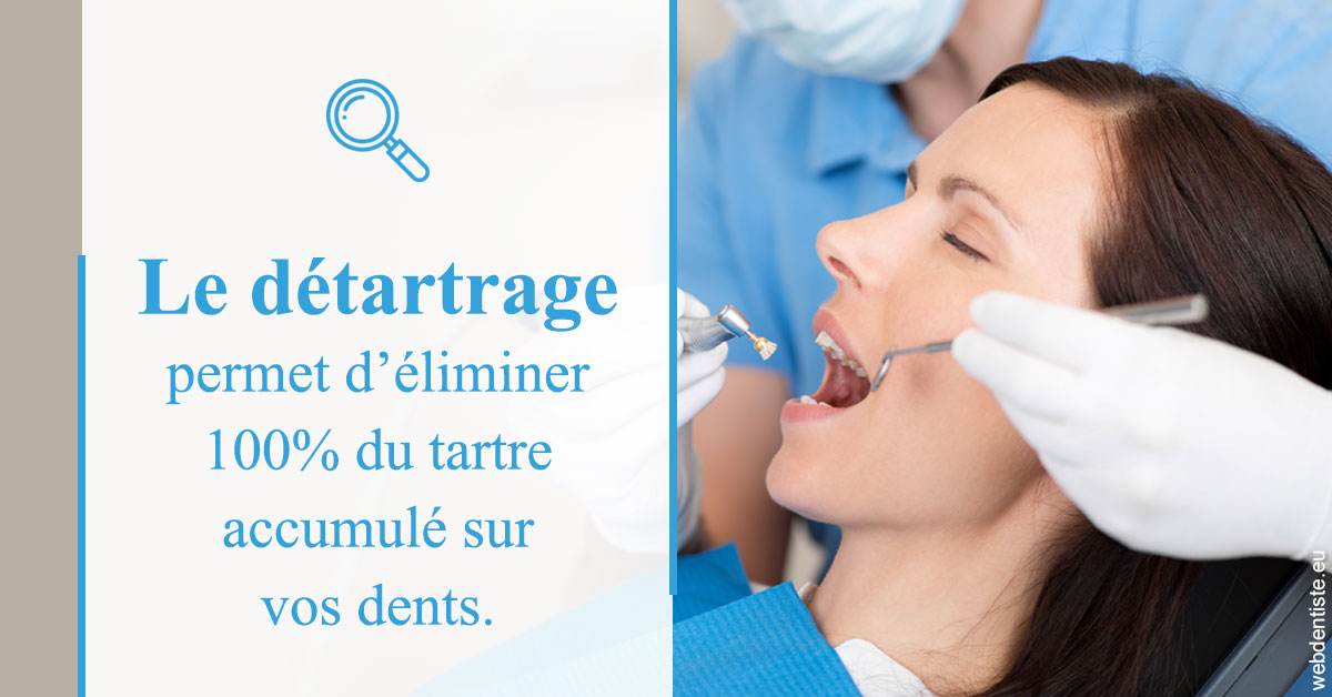 https://www.dentiste-pineau.fr/En quoi consiste le détartrage