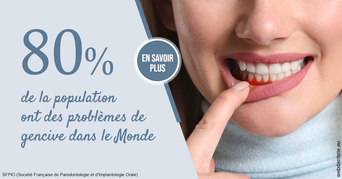 https://www.dentiste-pineau.fr/Problèmes de gencive 2
