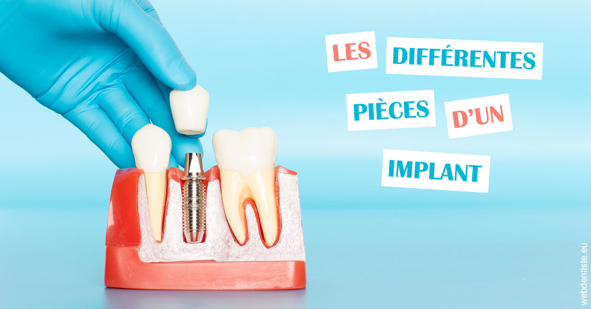 https://www.dentiste-pineau.fr/Les différentes pièces d’un implant 2