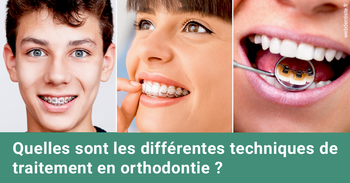 https://www.dentiste-pineau.fr/Les différentes techniques de traitement 2