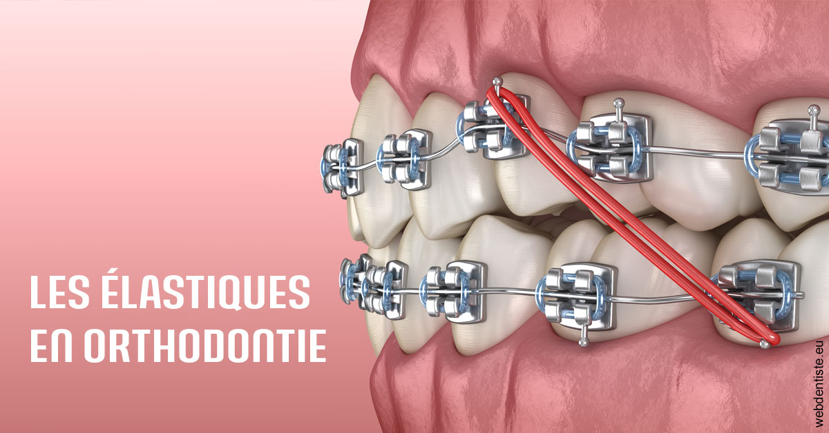 https://www.dentiste-pineau.fr/Elastiques orthodontie 2