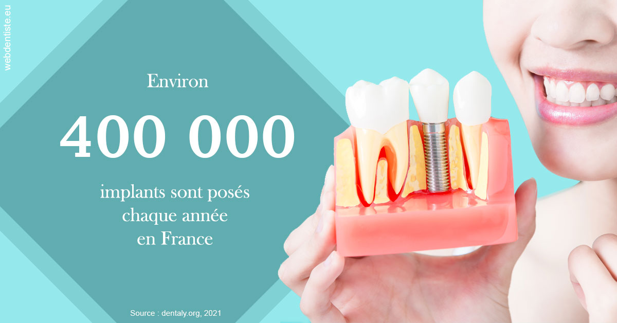 https://www.dentiste-pineau.fr/Pose d'implants en France 2