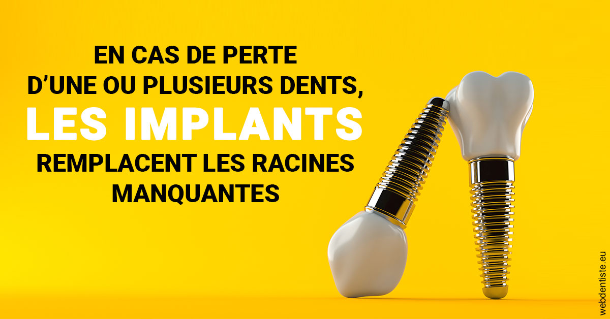 https://www.dentiste-pineau.fr/Les implants 2