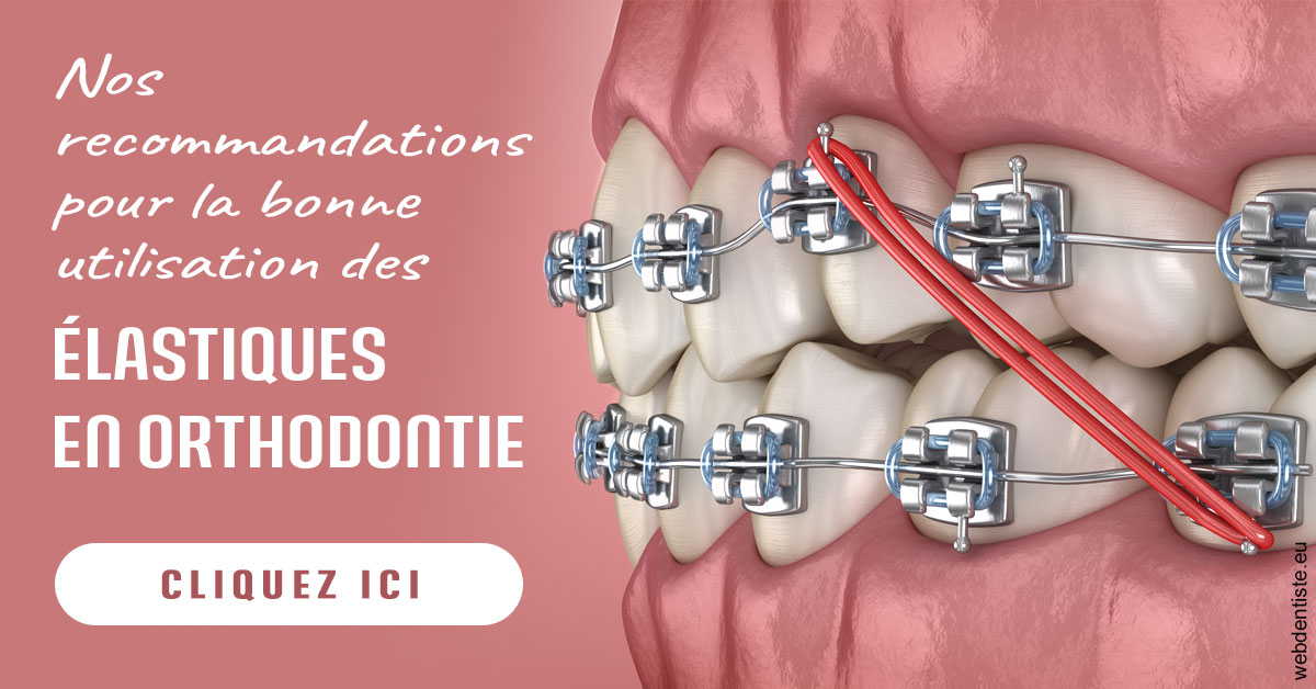 https://www.dentiste-pineau.fr/Elastiques orthodontie 2